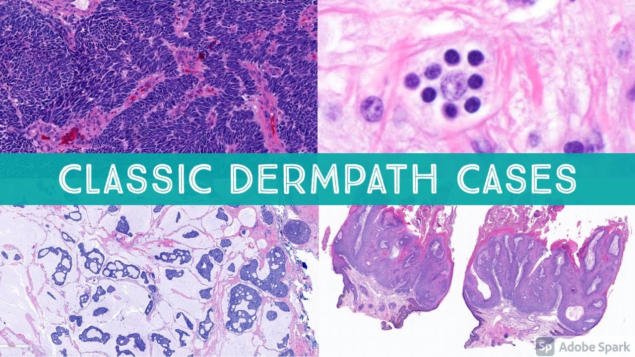 Classic Dermatopathology Cases! from the Head & Neck